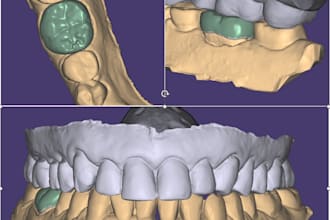 design your exocad crown accurately