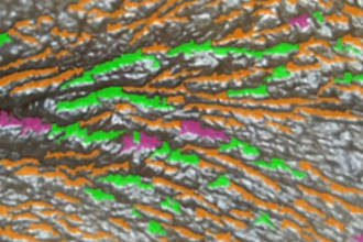 build skin and hair analysis system based on image processing and ai