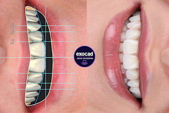 do professional exocad dental design for you