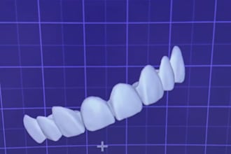 create custom crowns,bridges or full arches using exocad