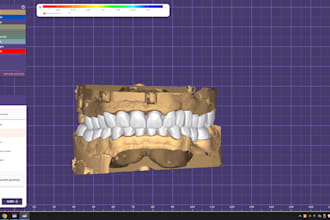 create custom crowns,bridges or full arches using exocad