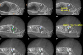 provide professional cbct radiology reporting