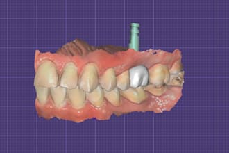 do expert dental designs on exocad