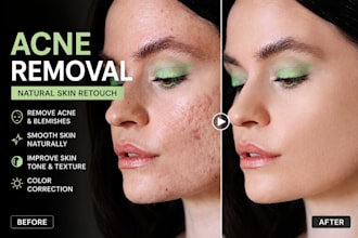 remove acne, blemishes and clean up skin professionally