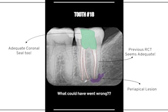 manually annotate animated dental xrays