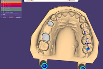 design dental crown and bridge using exocad