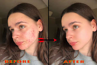 do face and skin retouch