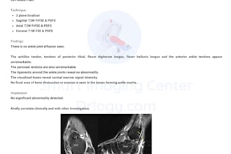 interpret radiology reports including xray, ct and mri with clear insights