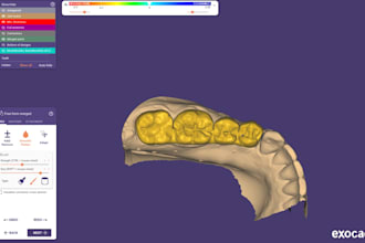 design dental crown and bridge cases in exocad