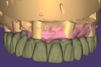 design crowns, bridges, implants, full arch cases using exocad