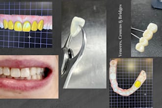 exocad workflows for crowns, bridges, implant restoration