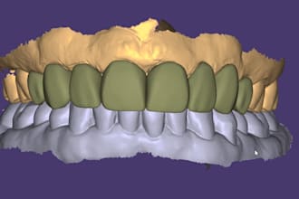 do expert digital dental design on exocade for veneers