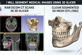 do medical image segmentation and 3d modeling using 3d slicer