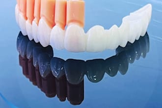 professional dental cad crown and bridge design in exocad