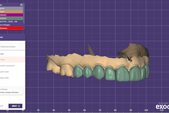 design crowns and bridges using exocad