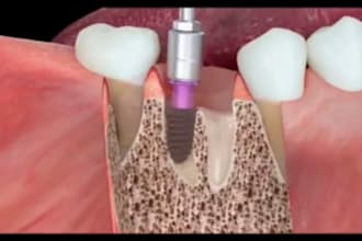 create 3d medical animation,3d dental animation, and 3d surgery video