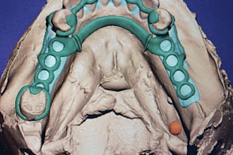 create high quality dental cad desings using exocad