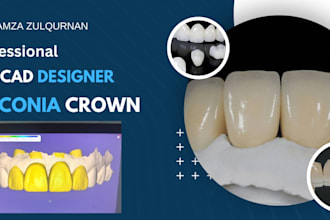 design high quality zirconia crown and bridge stl files