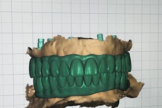 provide professional exocad dental cad design services