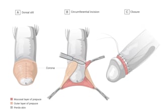 create medically accurate illustrations