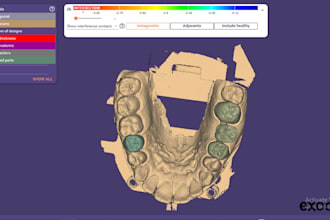 do exocad designing, including crowns, bridges, and implant restorations