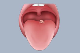 understand your health through your tongue