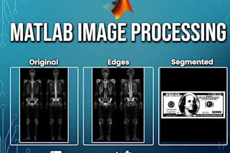 do matlab image processing, segmentation and computer vision