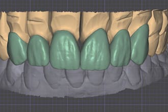 design dental crowns, bridges, and implant restorations