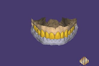 create a realistic digital snap on smile design for your patients