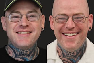 design 3d printed veneer smile makeovers using exocad