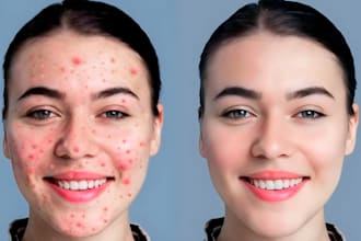 do professional skin retouching and remove acne blemishes