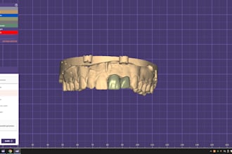 create custom crowns,bridges or full arches using exocad