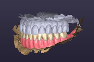 design functional and esthetic removable denture