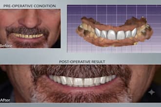 be your dental cad outsourcing partner for exocad and 3shape