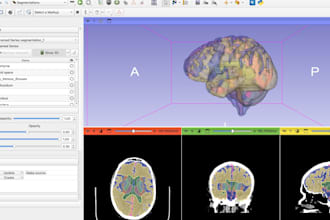create research grade brain mri ct scans segmentation and 3d models