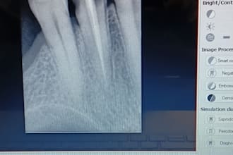 give dental second opinion
