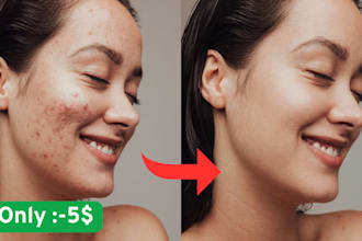 professional acne pimple blemish removal