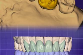 design high quality dental crowns and bridges in exocad