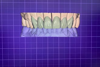 design high quality dental crowns and bridges in exocad
