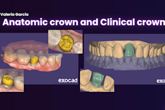 create precise exocad cad designs for dental labs