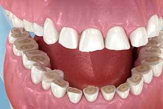 do 3d medical explainer video, 3d surgery, dental procedure, and 3d anatomy