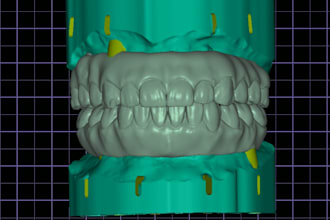 design high precision dental cad restorations, crowns, and veneers