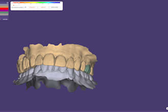 design exocad crowns bridges and full arch bridge