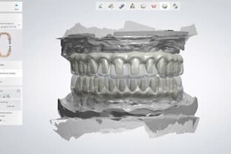 design dental cad restorations using exocad and 3shape