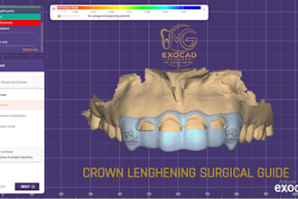 precise crown lengthening surgical guide