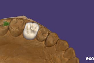design precise dental crowns in exocad fast turnaround