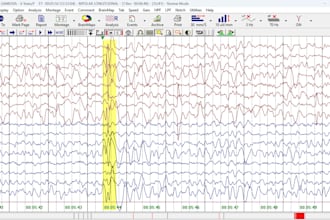 doeeg,ncv accurate report interpretation analysis and format