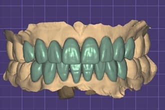 dental cad design service