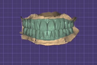 professional exocad dental cad design