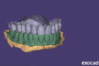 design professional exocad dental cad restorations
